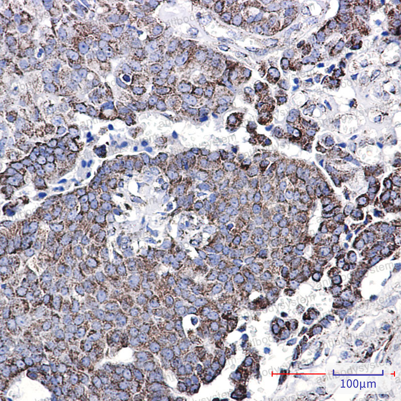 Anti-NDUFC2 Antibody (R1G38)