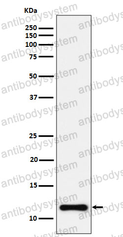 Anti-NDUFC2 Antibody (R1G37)