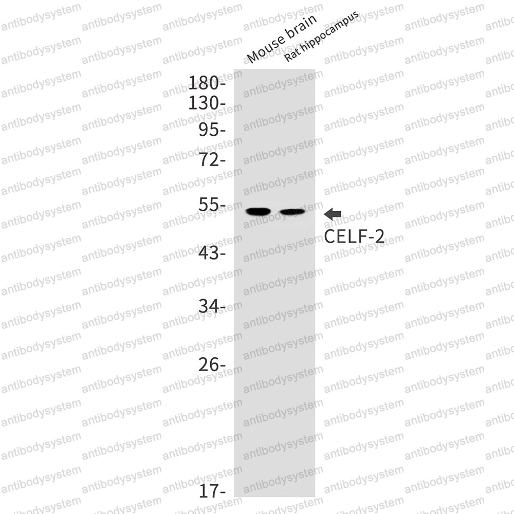 Anti-CELF2 Antibody (R1G39)