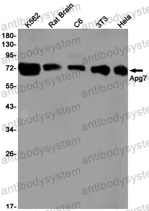 Anti-ATG7 Antibody (R1G41)