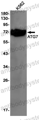 Anti-ATG7 Antibody (R1G40)