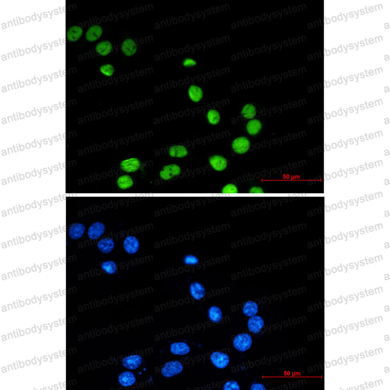 Anti-ZBTB7A Antibody (R1G43)