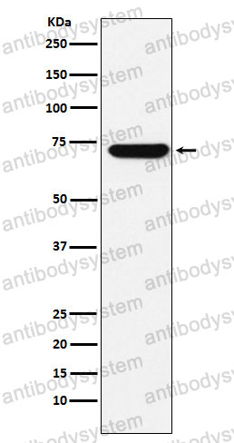 Anti-ZBTB7A Antibody (R1G42)