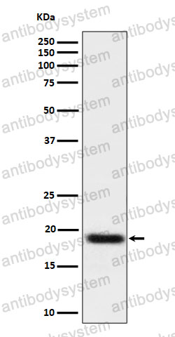 Anti-TNFAIP8 Antibody (R1G44)