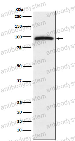 Anti-RAPGEF3/EPAC 1 Antibody (R1G47)