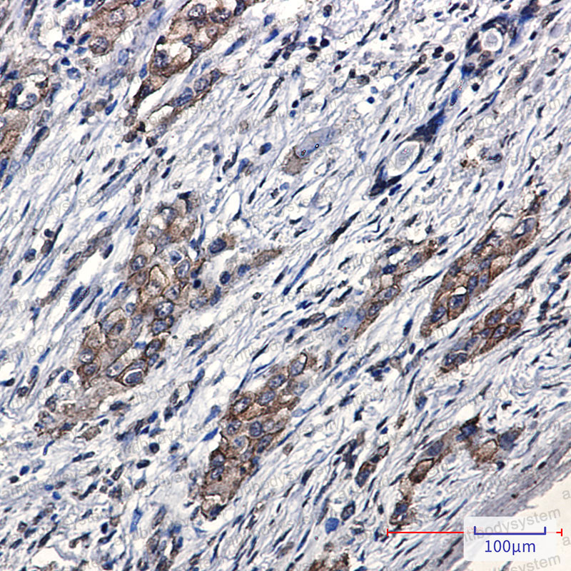 Anti-ZFYVE9 Antibody (R1G50)