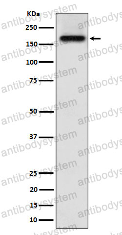 Anti-ZFYVE9 Antibody (R1G49)