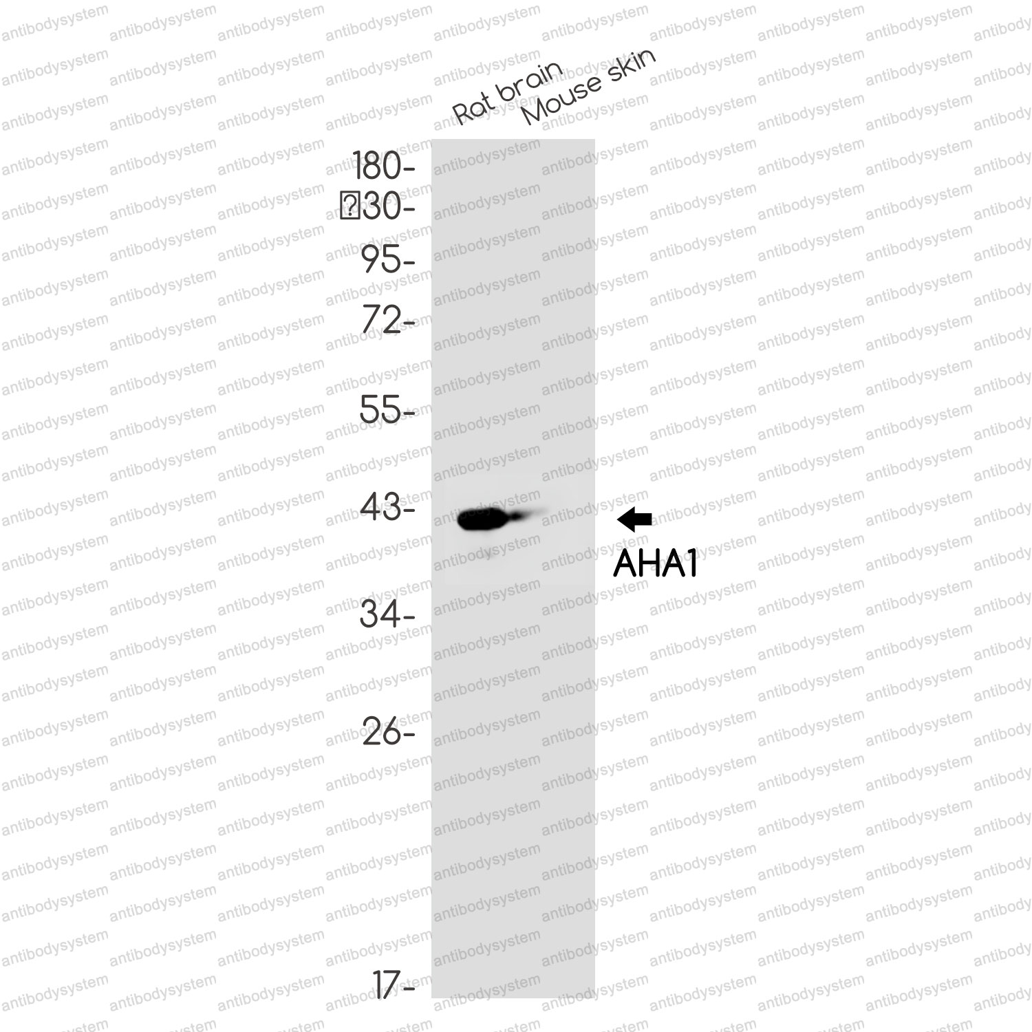 Anti-AHSA1 Antibody (R1G53)