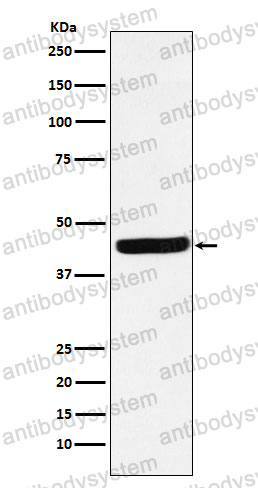Anti-AHSA1 Antibody (R1G52)