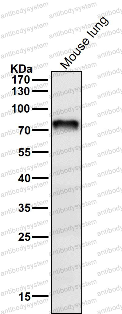 Anti-NTN1/Netrin-1 Antibody (R1G56)