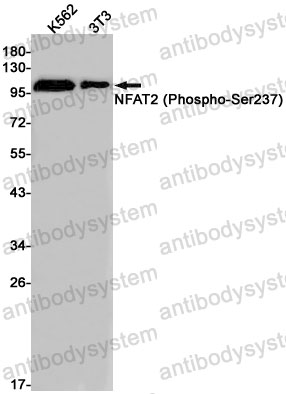Anti-Phospho-NFATC1/NFAT2 (Ser237) Antibody (R1G58)
