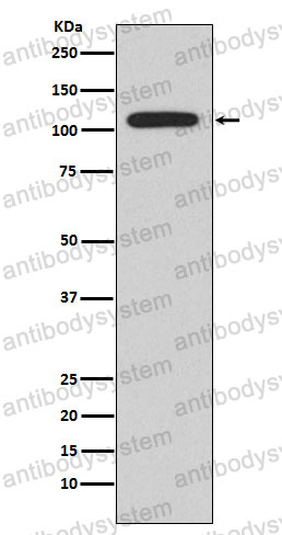 Anti-NFATC1 Antibody (R1G57)