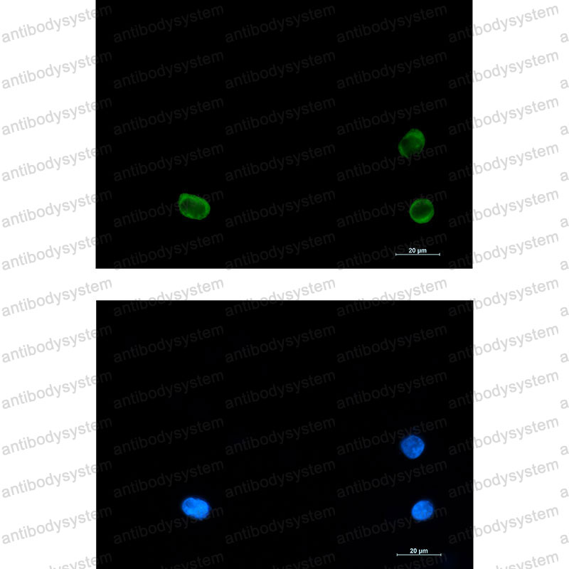 Anti-SNAP29 Antibody (R1G62)