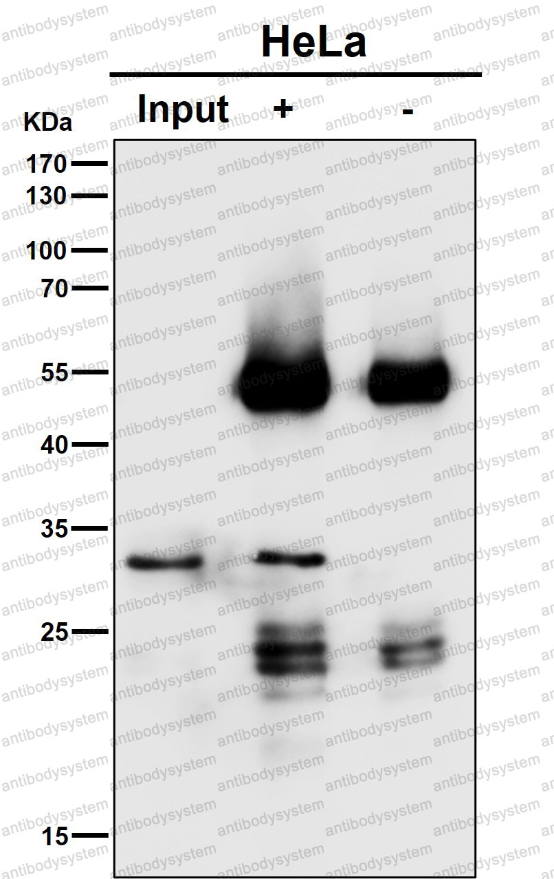 Anti-SNAP29 Antibody (R1G61)