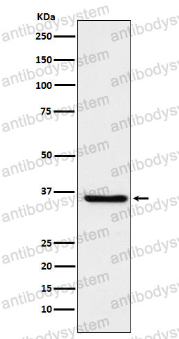 Anti-FGF19 Antibody (R1G63)