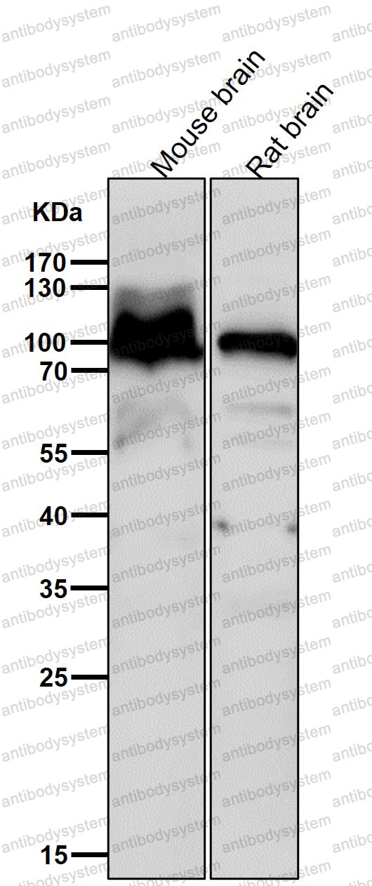 Anti-AP2A1 Antibody (R1G64)