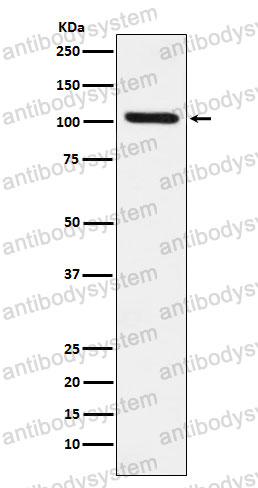Anti-DDX58 Antibody (R1G65)