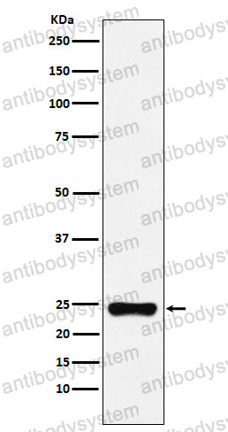 Anti-BAG2 Antibody (R1G68)