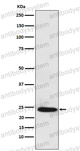 Anti-BAG2 Antibody (R1G69)