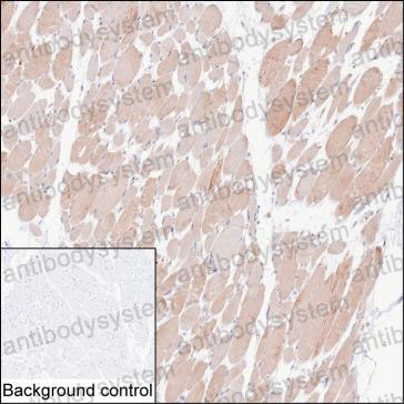 Immunohistochemical for Anti-BAG3 Antibody (R2W43) ?>