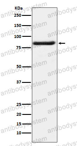 Anti-BAG3 Antibody (R1G70)