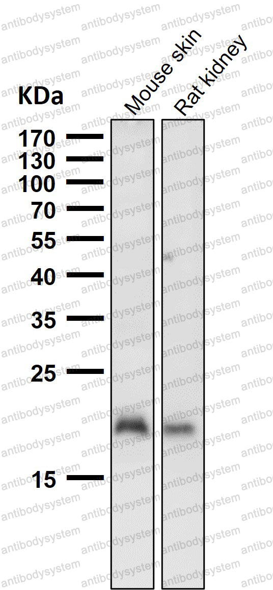 Anti-CLDN1/Claudin-1 Antibody (R1G73)
