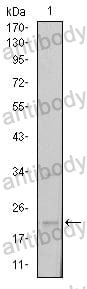 Western blot for Anti-SNAI1 Antibody (R2W46) ?>