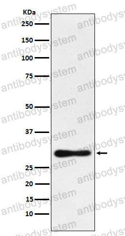 Anti-DDAH2 Antibody (R1G74)