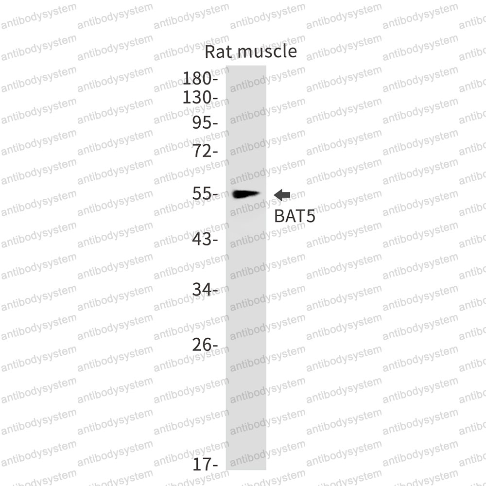 Anti-BAT5/ABHD16A Antibody (R1G75)