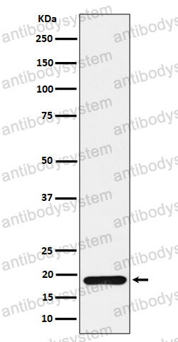 Anti-TXNDC12 Antibody (R1G76)