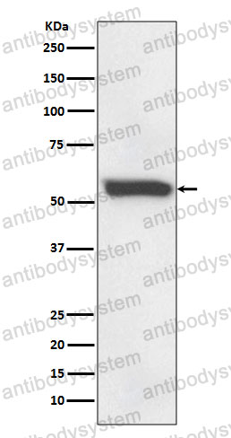Anti-FTCD Antibody (R1G78)