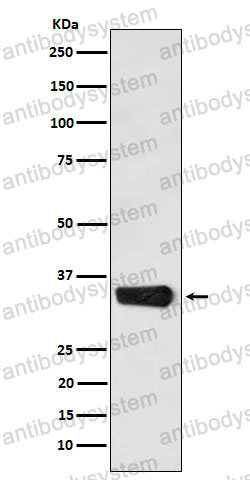 Anti-MBD3 Antibody (R1G82)