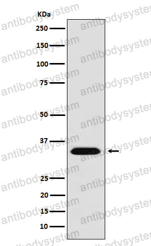 Anti-MBD3 Antibody (R1G81)