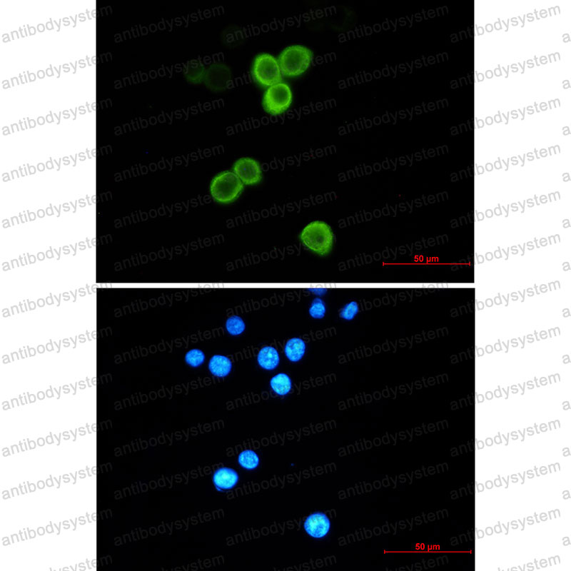Anti-AGR2/HPC8 Antibody (R1G83)