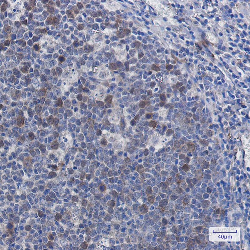 Anti-PTTG1 Antibody (R1G85)