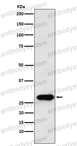 Anti-PTTG1 Antibody (R1G84)