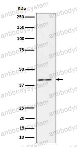 Anti-IL18BP Antibody (R1G86)