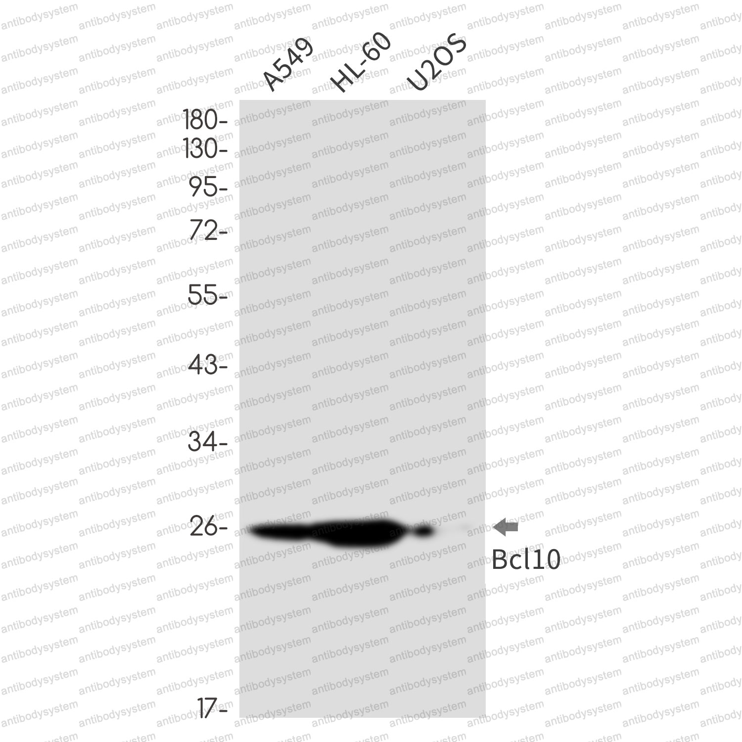 Anti-BCL10 Antibody (R1G88)