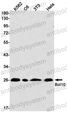 Anti-BCL10 Antibody (R1G87)