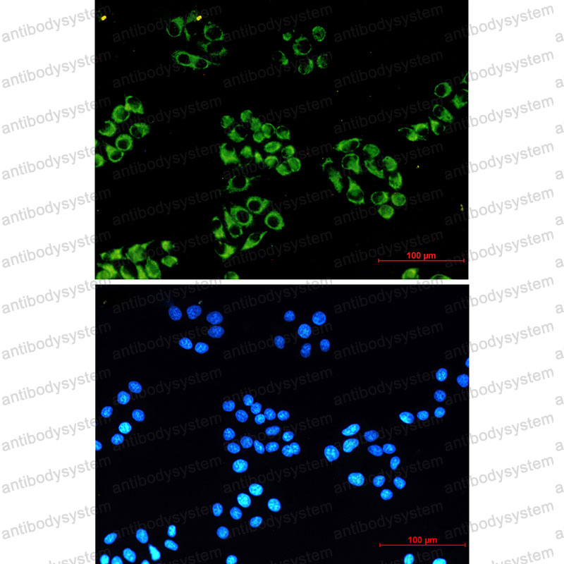Anti-NDUFB10 Antibody (R1G90)