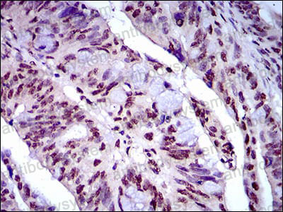 Immunohistochemical for Anti-NAPSA Antibody (R2W58) ?>