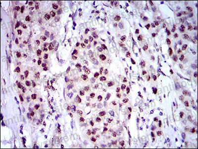 Immunohistochemical for Anti-NAPSA Antibody (R2W58) ?>