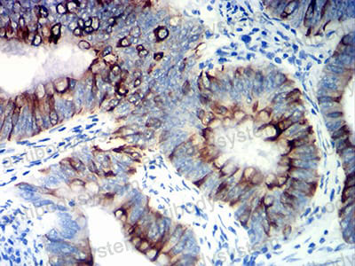 Immunohistochemical for Anti-NAPSA Antibody (R2W59) ?>