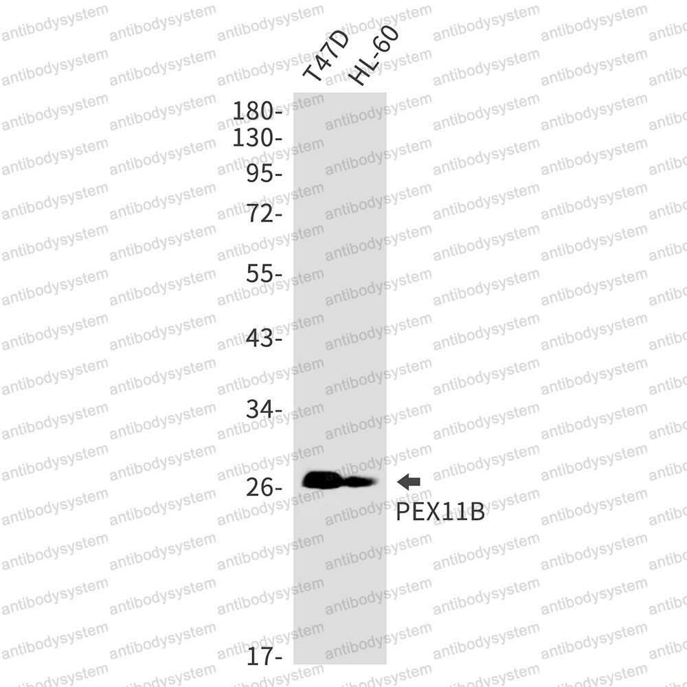 Anti-PEX11B Antibody (R1G94)