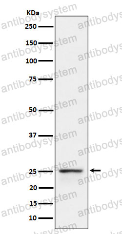 Anti-PEX11B Antibody (R1G93)