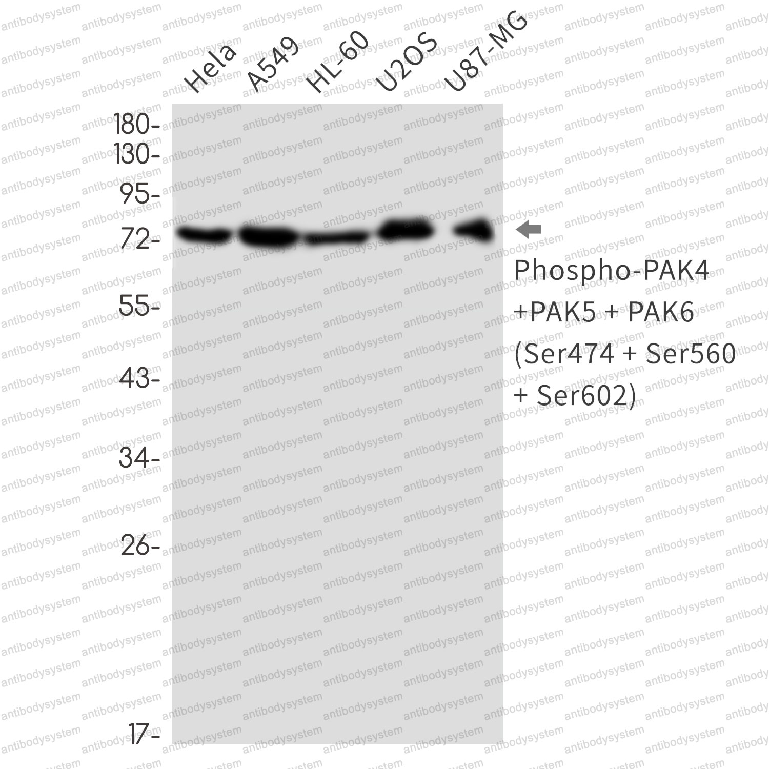 Anti-Phospho-PAK4/5/6 (Ser474/Ser560/Ser602) Antibody (R1G96)