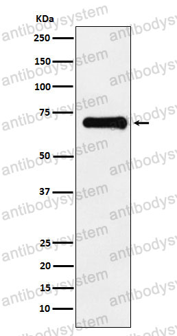 Anti-Phospho-PAK4 + PAK5 + PAK6 (S474 + S560 + S602) Antibody (R1G95)