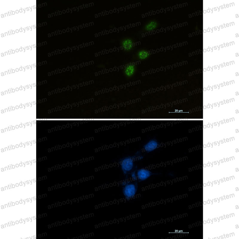 Anti-CHEK2 Antibody (R1G98)