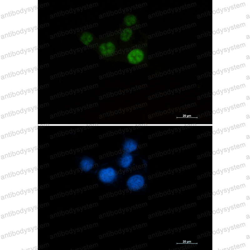 Anti-CHEK2 Antibody (R1G97)
