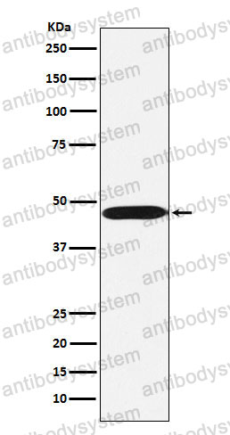 Anti-ACTL6A Antibody (R1G99)